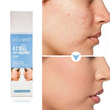 Load image into Gallery viewer, Acne Removal Acne Cream Control Anti-Acne Gel Treatment Lighten Acne Marks Skin Care Whitening Eliminate Pimples Facial Cream