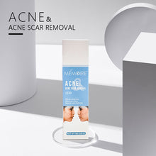 Load image into Gallery viewer, Acne Removal Acne Cream Control Anti-Acne Gel Treatment Lighten Acne Marks Skin Care Whitening Eliminate Pimples Facial Cream