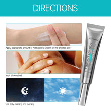 Load image into Gallery viewer, Against Psoriasis Cream Natural Herbal Ointment Antibacterial Gel Anti-Itch Eczematoid Urticaria Psoriasis Skin Care Cream