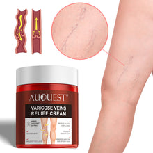 Load image into Gallery viewer, Varicose Veins Treatment Cream Relieve Tired Legs Dilated Phlebitis Spider Pain Relief Ointment Body Care Varicose Veins Cream
