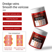 Load image into Gallery viewer, Varicose Veins Treatment Cream Relieve Tired Legs Dilated Phlebitis Spider Pain Relief Ointment Body Care Varicose Veins Cream