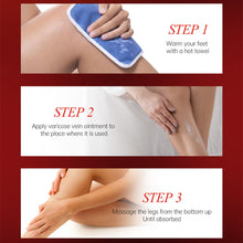 Load image into Gallery viewer, Varicose Veins Treatment Cream Relieve Tired Legs Dilated Phlebitis Spider Pain Relief Ointment Body Care Varicose Veins Cream