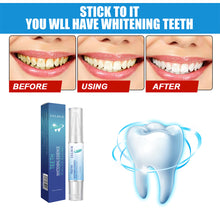 Load image into Gallery viewer, Teeth Cleaning Pen Oral Cleaning Teeth Whitening Pen Remove Stains Teeth Cleaning Pen Oral Hygiene Care