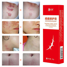 Load image into Gallery viewer, Scar Repair Cream Acne Remove Gel Acne Pits Acne Scars Spots Surgical Scars Treatment Repair Cream Smooth Body Skin Care