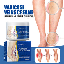 Load image into Gallery viewer, Worm Legs Varicose Vein Repair Cream Repair Vasculitis Phlebitis Massage Varicose Massage Earthworm Leg Pain Topical Cream