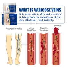 Load image into Gallery viewer, Worm Legs Varicose Vein Repair Cream Repair Vasculitis Phlebitis Massage Varicose Massage Earthworm Leg Pain Topical Cream