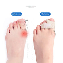 Load image into Gallery viewer, Silicone Toe Separator Bunion Hallux Valgus Corrector Thumb Finger Correction Straightener Foot Belt Care Elastic Toe Splitter