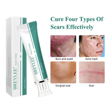 Load image into Gallery viewer, Scar Remover Cream Stretch Acne Treatment Scars Removal Skin Repair Cream Whitening Dark Spot Remover Cream Face Skin Care