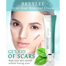 Load image into Gallery viewer, Scar Remover Cream Stretch Acne Treatment Scars Removal Skin Repair Cream Whitening Dark Spot Remover Cream Face Skin Care