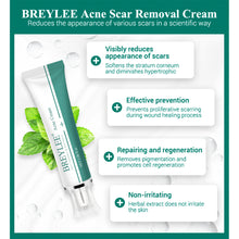 Load image into Gallery viewer, Scar Remover Cream Stretch Acne Treatment Scars Removal Skin Repair Cream Whitening Dark Spot Remover Cream Face Skin Care
