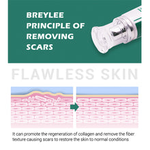 Load image into Gallery viewer, Scar Remover Cream Stretch Acne Treatment Scars Removal Skin Repair Cream Whitening Dark Spot Remover Cream Face Skin Care