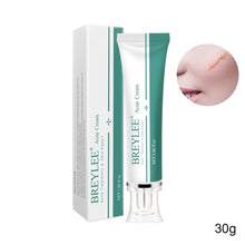 Load image into Gallery viewer, Scar Remover Cream Stretch Acne Treatment Scars Removal Skin Repair Cream Whitening Dark Spot Remover Cream Face Skin Care
