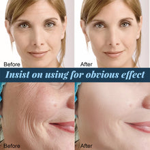 Load image into Gallery viewer, Protein Lifting Line Lift Tighten Facial Contour Reduce Facial Fine Lines Repairing Moisturizing Facial Protein Line Skin Care