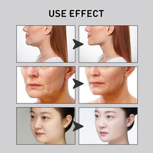 Load image into Gallery viewer, 40patches V-Shaped Face Lifter Stick Skin Contraction Jaw Line Face Invisible Droop Slack Anti-Wrinkle Chin Line Sagging Lift Patch