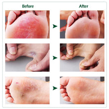 Load image into Gallery viewer, Refreshing Comfortable Moist Antibacterial Nursing Hand Foot Cream Herbal Foot Fungus Removal Cream Toe Fungus Repair Feet Care