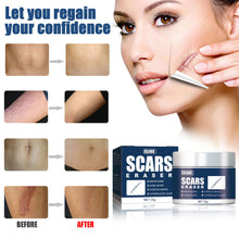Load image into Gallery viewer, Skin Scar Gel Cream Cold Compress Burn Scar Cream Fade Surgical Scar Repair Cream Effective Acne Scar Removal Cream