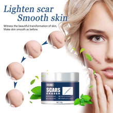 Load image into Gallery viewer, Skin Scar Gel Cream Cold Compress Burn Scar Cream Fade Surgical Scar Repair Cream Effective Acne Scar Removal Cream
