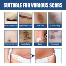 Load image into Gallery viewer, Skin Scar Gel Cream Cold Compress Burn Scar Cream Fade Surgical Scar Repair Cream Effective Acne Scar Removal Cream