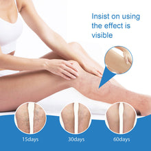 Load image into Gallery viewer, Herbal Varicose Veins Treatment Cream Relieve Tired Legs Dilated Vasculitis Phlebitis Spider Pain Relief Ointment Body Care