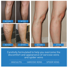Load image into Gallery viewer, Herbal Varicose Veins Treatment Cream Relieve Tired Legs Dilated Vasculitis Phlebitis Spider Pain Relief Ointment Body Care
