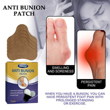 Load image into Gallery viewer, 5pcs/box Anti-bunion Patches Correct Foot Thumb Eversion Relieve Swelling Pain Foot Care Patches Health Care