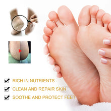Load image into Gallery viewer, Cracked Skin Banana Repair Cream Foot Crack Prevention Repair Moisturize Anti-chapped Cream Hand Foot Care