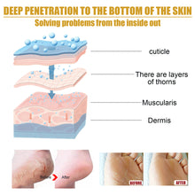 Load image into Gallery viewer, Cracked Skin Banana Repair Cream Foot Crack Prevention Repair Moisturize Anti-chapped Cream Hand Foot Care