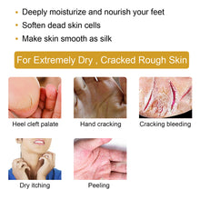 Load image into Gallery viewer, Cracked Skin Banana Repair Cream Foot Crack Prevention Repair Moisturize Anti-chapped Cream Hand Foot Care