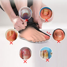 Load image into Gallery viewer, Professional Pedicure Recover Embed Toe Nail Treatment Ingrown Toenail Corrector Tools Onychia Lateralis Correction Foot Care Tool