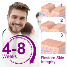 Load image into Gallery viewer, Silicone Women Invisible Efficient Surgery Scar Removal Gel Therapy Patches Acne Trauma Scald Scar Skin Repair Caesarean Section Treatment