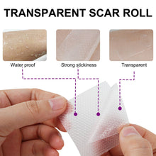 Load image into Gallery viewer, Silicone Women Invisible Efficient Surgery Scar Removal Gel Therapy Patches Acne Trauma Scald Scar Skin Repair Caesarean Section Treatment