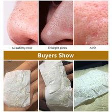 Load image into Gallery viewer, Face Blackheads Remover Peel Off Blackhead Mask Skin Care Nose Pore Strips Stickers Acne Treatment Facial Nasal Masks