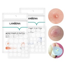 Load image into Gallery viewer, Mini Acne Pimple Patch Invisible Acne Removal Patches Acne Treatment Acne Master Pimple Remover Daily / Night Stickers