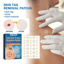 Load image into Gallery viewer, 180PCS Skin Tag Wart Remove Wart Acuminate Skin Repair Stick Acne Pimple Patch Pimple Treatments Patches Cream Warts Sticker