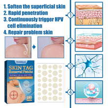 Load image into Gallery viewer, 180PCS Skin Tag Wart Remove Wart Acuminate Skin Repair Stick Acne Pimple Patch Pimple Treatments Patches Cream Warts Sticker