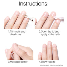 Load image into Gallery viewer, Nail Fungal Removal Treatment Essence Pen Anti Infection Paronychia Onychomycosis Nail Repair Pen Foot Toenail Gel Feet Care Repair Liquid