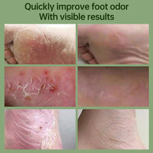 Load image into Gallery viewer, Foot Beriberi Spary Fungal Removal Odor Smell Remove Anti Itch Sweat Athletes Feet Shoe Sock Skin Care Spray Antiperspirant Shoes