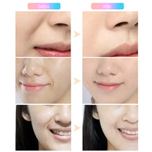 Load image into Gallery viewer, Anti-wrinkle Nasolabial Folds Removal Gel Patch Firming Mask Face Skin Care Treatment Stickers Anti-aging Moisturizng Face Patch