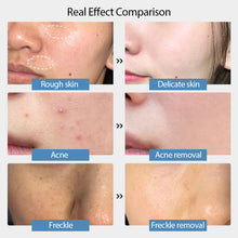 Load image into Gallery viewer, Anti Wrinkle Retinol Face Serum Face Essence Dark Spots Removal Shrink Pores Face Firmer Moisturizing Collagen Essence Liquid