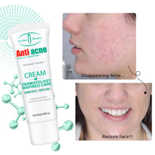 Load image into Gallery viewer, Herbal Acne Spots Oil Control Gel Moisturizing Acne Removal Cream Remove Pimple Acne Scar Cream Whitening Smooth Skin Care