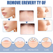 Load image into Gallery viewer, 144pcs Wart Treatment Stickers Skin Tag Remover Patches Treatments Hydrocolloid Gel Acne Warts Invisible Skin Care