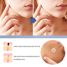 Load image into Gallery viewer, 144pcs Wart Treatment Stickers Skin Tag Remover Patches Treatments Hydrocolloid Gel Acne Warts Invisible Skin Care