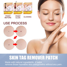 Load image into Gallery viewer, 144pcs Wart Treatment Stickers Skin Tag Remover Patches Treatments Hydrocolloid Gel Acne Warts Invisible Skin Care