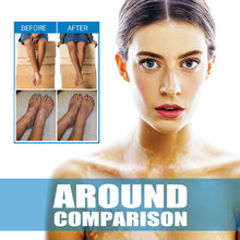 Load image into Gallery viewer, White Spot Removal Extract Vitiligo Ointment Remove Ringworm Skin White Spot Leukoplakia Disease Treatment Cream