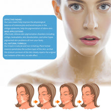 Load image into Gallery viewer, White Spot Removal Extract Vitiligo Ointment Remove Ringworm Skin White Spot Leukoplakia Disease Treatment Cream