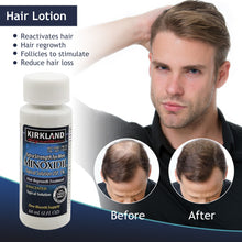 Load image into Gallery viewer, 1 Original Kirkland Minoxidil with FREE LCLT and Dropper Hair Grower Beard Grower Creative Effective Hair Growth Health Care