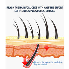 Load image into Gallery viewer, 1 Original Kirkland Minoxidil with FREE LCLT and Dropper Hair Grower Beard Grower Creative Effective Hair Growth Health Care