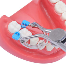 Load image into Gallery viewer, Dental Doublet Shaped Sheet Clamp Shaped Sheet Clamp Doublet Shaped Sheet Clamp Tooth Doublet Holding Ring
