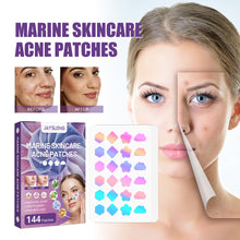 Load image into Gallery viewer, Colorful Acne Patches Fade Spots Acne Hydrogel Patches Repair Facial Acne Defects Skin Care Beauty Health