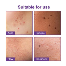 Load image into Gallery viewer, Colorful Acne Patches Fade Spots Acne Hydrogel Patches Repair Facial Acne Defects Skin Care Beauty Health